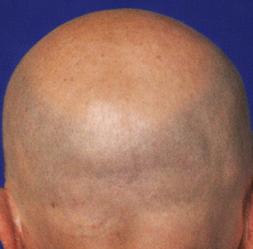 Before/After Image